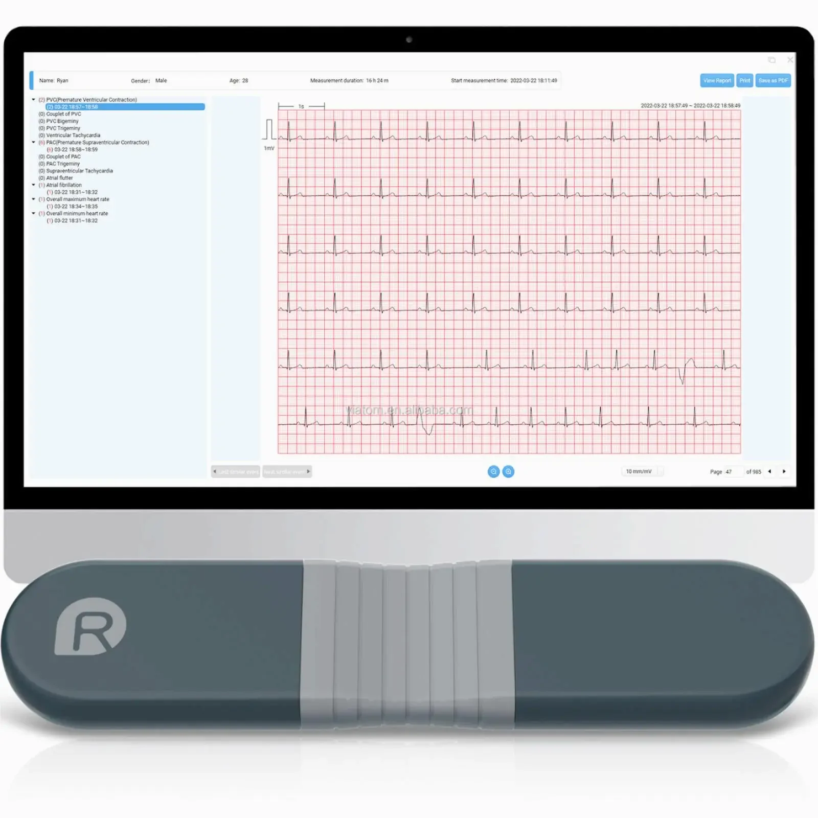 무선 블루투스 다이나믹 레코더 실시간 홀터 168시간  - Ecg Patch Monitor 리뷰 및 가격